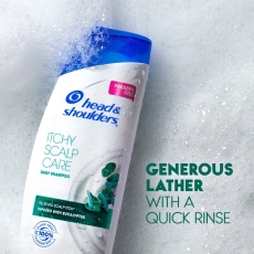 Head and Shoulders Itchy Scalp...